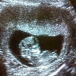 Due date +3 and a big surprise!